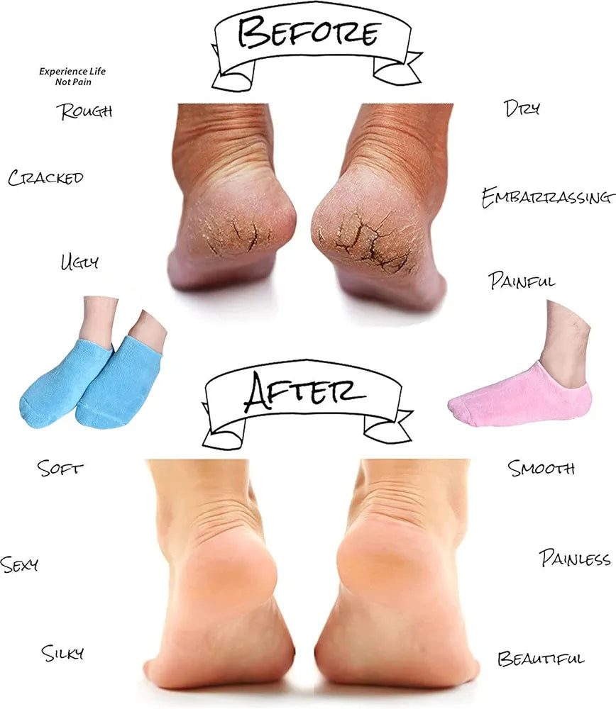Moisturizing Socks, Gel Socks Soft Moisturizing Gel Socks, Gel Spa Socks for Repairing and Softening Dry Cracked Feet Skins )